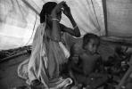 Tuberculosis, Refugee Camp, near the Ethiopia Somalia border, African Diaspora, Somalia, POV35V07P44_21