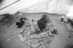 Tuberculosis, Refugee Camp, near the Ethiopia Somalia border, African Diaspora, Somalia, POV35V07P44_26