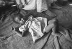 Tuberculosis, Refugee Camp, near the Ethiopia Somalia border, African Diaspora, Somalia, POV35V07P44_32