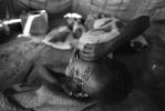 Tuberculosis, Refugee Camp, near the Ethiopia Somalia border, African Diaspora, Somalia, POV35V07P44_35