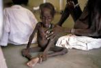 Starving LIttle Boy, Mother, Lake Turkana, POVV01P06_04