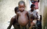 Malnourished Boy, POVV01P10_16