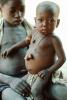 Malnourished Boy, belly, POVV01P11_01B