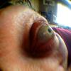 Eye of Vern, XPFD01_020